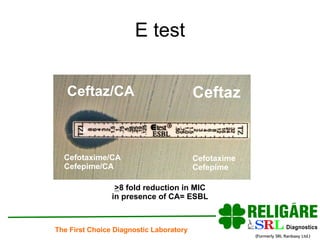 E test Ceftaz/CA Ceftaz > 8 fold reduction in MIC in presence of CA= ESBL Cefotaxime/CA Cefepime/CA Cefotaxime Cefepime 