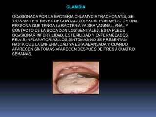 OCASIONADA POR LA BACTERIA CHLAMYDIA TRACHOMATIS, SE
TRANSMITE ATRAVEZ DE CONTACTO SEXUAL POR MEDIO DE UNA
PERSONA QUE TENGA LA BACTERIA YA SEA VAGINAL, ANAL Y
CONTACTO DE LA BOCA CON LOS GENITALES, ESTA PUEDE
OCASIONAR INFERTILIDAD, ESTERILIDAD Y ENFERMEDADES
PELVIS INFLAMATORIAS. LOS SÍNTOMAS NO SE PRESENTAN
HASTA QUE LA ENFERMEDAD YA ESTA ABANSADA Y CUANDO
APARECEN SÍNTOMAS APARECEN DESPUÉS DE TRES A CUATRO
SEMANAS.

 