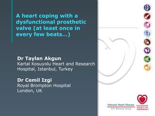 A heart coping with a
dysfunctional prosthetic
valve (at least once in
every few beats…)

Dr Taylan Akgun

Kartal Kosuyolu Heart and Research
Hospital, Istanbul, Turkey

Dr Cemil Izgi

Royal Brompton Hospital
London, UK

 