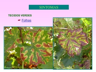 10
SINTOMAS
TECIDOS VERDES
 Folhas
 