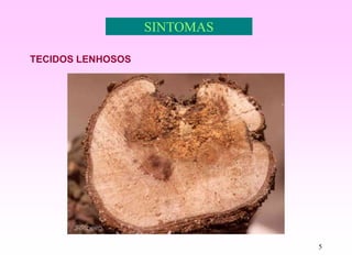 5
SINTOMAS
TECIDOS LENHOSOS
 