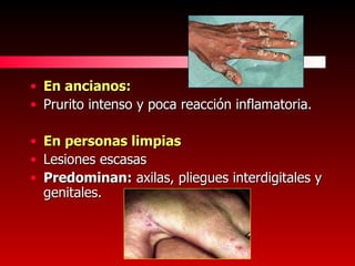 En ancianos: Prurito intenso y poca reacción inflamatoria. En personas limpias Lesiones escasas Predominan:  axilas, pliegues interdigitales y genitales. 