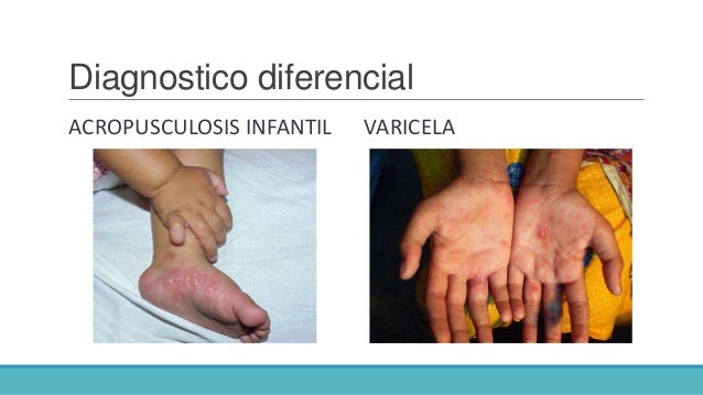 Los sanatorios para los niños desde 2 años atopichesky la dermatitis
