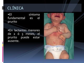 El síntoma
fundamental es el
prurito
En lactantes menores
de 2 ó 3 meses, el
prurito puede estar
ausente.
CLÍNICA
 