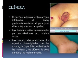 CLÍNICA
 Pequeños nódulos eritematosos,
infiltrados al tacto,
preferentemente en el pene y en
el escroto, e incluso ampollas.
 Las lesiones están enmascaradas
por excoriaciones en muchos
casos.
 Las zonas afectadas son los
espacios interdigitales de las
manos, la superficie de flexión de
las muñecas , los glúteos, la zona
genital y la areola mamaria.
 