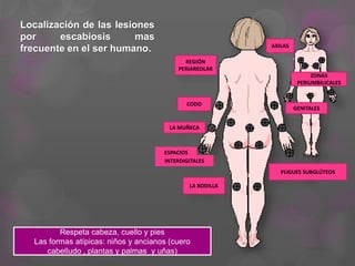 Localización de las lesiones
por escabiosis mas
frecuente en el ser humano. AXILAS
CODO
LA MUÑECA
ESPACIOS
PLIGUES SUBGLÚTEOS
ZONAS
PERIUMBILICALES
GENITALES
REGIÓN
PERIAREOLAR
LA RODILLA
Respeta cabeza, cuello y pies
Las formas atípicas: niños y ancianos (cuero
cabelludo , plantas y palmas y uñas)
INTERDIGITALES
 