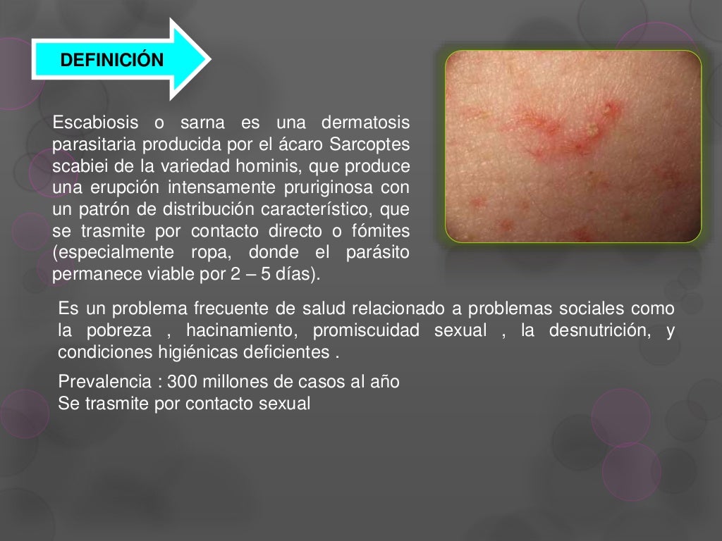 ESCABIOSIS