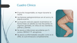 Cuadro Clínico
 El prurito insoportable, es mayor durante la
noche.
 Las lesiones patognomónicas son el surco y la
pápula acarina
 La erupción vesiculo-papulo-eczematoso en
forma lineal, en adultos es mas frecuentes en
regiones genitales, en niños en los miembros,
palmas y plantas.
 Se asocia a infecciones secundarias por S.
aureus, EBHGA Y P. aeruginosa.
 Se asocia a enfermedades sexuales como es la
sífilis, la cual enmascara completamente.
 
