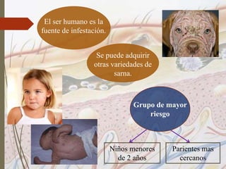El ser humano es la
fuente de infestación.
Se puede adquirir
otras variedades de
sarna.
Grupo de mayor
riesgo
Niños menores
de 2 años
Parientes mas
cercanos
 