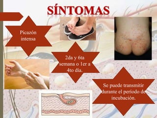 Picazón
intensa
2da y 6ta
semana o 1er a
4to día.
Se puede transmitir
durante el período de
incubación.
 