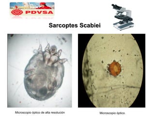 Sarcoptes ScabieiSarcoptes Scabiei
Microscopio óptico de alta resolución Microscopio óptico.
 