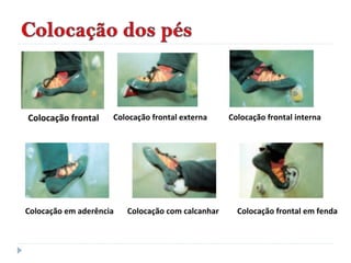 Colocação frontal Colocação frontal externa Colocação frontal interna
Colocação em aderência Colocação com calcanhar Colocação frontal em fenda
 