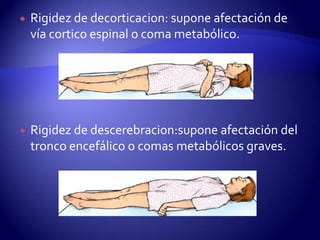    Rigidez de decorticacion: supone afectación de
    vía cortico espinal o coma metabólico.




   Rigidez de descerebracion:supone afectación del
    tronco encefálico o comas metabólicos graves.
 