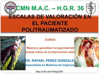 CURSO:
Mejorar y garantizar la seguridad del
paciente crítico en la intervención médica
DR. RAFAEL PEREZ GONZALEZ
Especialista en Medicina de Urgencias
ESCALAS DE VALORACIÓN EN
EL PACIENTE
POLITRAUMATIZADO
CMN M.A.C. – H.G.R. 36
http://1drv.ms/1HxquOW
 