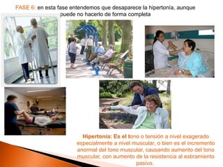 FASE 6: en esta fase entendemos que desaparece la hipertonía, aunque
                 puede no hacerlo de forma completa




                         Hipertonía: Es el tono o tensión a nivel exagerado
                       especialmente a nivel muscular, o bien es el incremento
                       anormal del tono muscular, causando aumento del tono
                       muscular, con aumento de la resistencia al estiramiento
                                              pasivo.
 