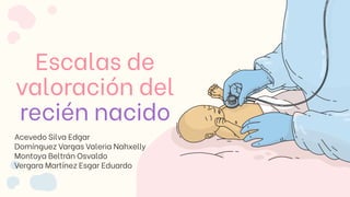 Escalas de
valoración del
recién nacido
Acevedo Silva Edgar
Domínguez Vargas Valeria Nahxelly
Montoya Beltrán Osvaldo
Vergara Martínez Esgar Eduardo
 
