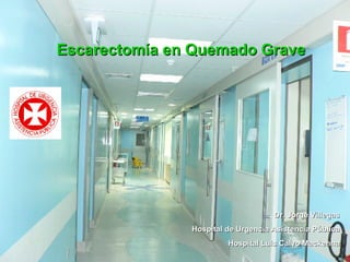 Escarectomía en Quemado Grave Dr. Jorge Villegas Hospital de Urgencia Asistencia Pública Hospital Luis Calvo Mackenna 