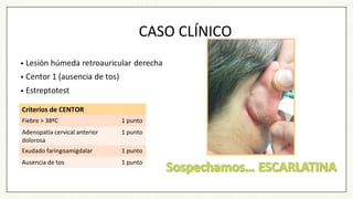 CASO CLÍNICO
Criterios de CENTOR
Fiebre > 38ºC 1 punto
Adenopatía cervical anterior
dolorosa
1 punto
Exudado faringoamigdalar 1 punto
Ausencia de tos 1 punto
 