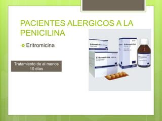 PACIENTES ALERGICOS A LA
PENICILINA
 Eritromicina
Tratamiento de al menos
10 días
 