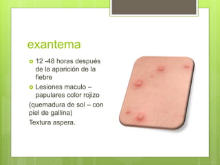 exantema
 12 -48 horas después
de la aparición de la
fiebre
 Lesiones maculo –
papulares color rojizo
(quemadura de sol – con
piel de gallina)
Textura aspera.
 