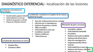 GPC
DIAGNÓSTICO DIFERENCIAL– localización de las lesiones
 