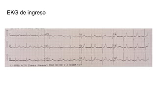 EKG de ingreso
 