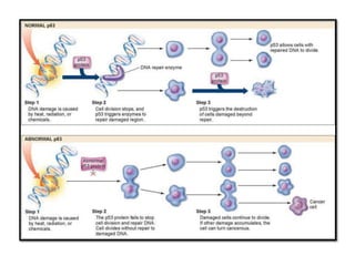 Escc esophageal squamous cell carcinoma | PPTX