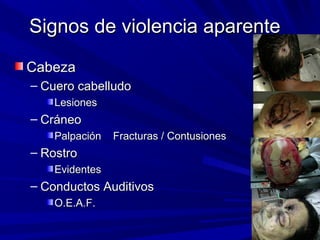 SSiiggnnooss ddee vviioolleenncciiaa aappaarreennttee 
CCaabbeezzaa 
– CCuueerroo ccaabbeelllluuddoo 
LLeessiioonneess 
– CCrráánneeoo 
PPaallppaacciióónn FFrraaccttuurraass // CCoonnttuussiioonneess 
– RRoossttrroo 
EEvviiddeenntteess 
– CCoonndduuccttooss AAuuddiittiivvooss 
OO..EE..AA..FF.. 
 