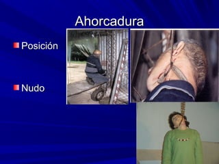 AAhhoorrccaadduurraa 
PPoossiicciióónn 
NNuuddoo 
 