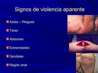 d Signos dee vviioolleenncciiaa aappaarreennttee 
AAxxiillaass –– PPlliieegguueess 
TTóórraaxx 
AAbbddoommeenn 
EExxttrreemmiiddaaddeess 
GGeenniittaalleess 
RReeggiióónn aannaall 
 