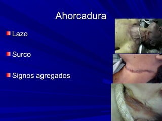 AAhhoorrccaadduurraa 
LLaazzoo 
SSuurrccoo 
SSiiggnnooss aaggrreeggaaddooss 
 