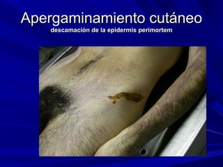 AAppeerrggaammiinnaammiieennttoo ccuuttáánneeoo 
ddeessccaammaacciióónn ddee llaa eeppiiddeerrmmiiss ppeerriimmoorrtteemm 
 