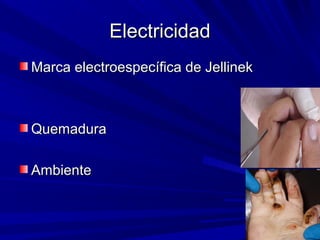 EElleeccttrriicciiddaadd 
MMaarrccaa eelleeccttrrooeessppeeccííffiiccaa ddee JJeelllliinneekk 
QQuueemmaadduurraa 
AAmmbbiieennttee 
 