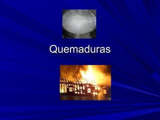 QQuueemmaadduurraass 
 