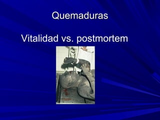 QQuueemmaadduurraass 
Vitalidad vs. postmortem 
 