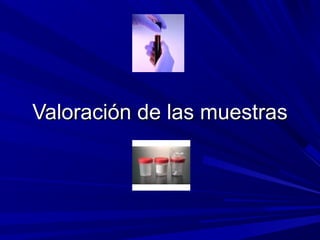 VVaalloorraacciióónn ddee llaass mmuueessttrraass 
 