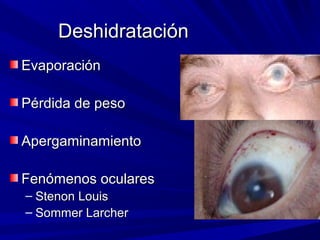 DDeesshhiiddrraattaacciióónn 
EEvvaappoorraacciióónn 
PPéérrddiiddaa ddee ppeessoo 
AAppeerrggaammiinnaammiieennttoo 
FFeennóómmeennooss ooccuullaarreess 
– SStteennoonn LLoouuiiss 
– SSoommmmeerr LLaarrcchheerr 
 