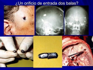 ¿UUnn oorriiffiicciioo ddee eennttrraaddaa ddooss bbaallaass?? 
 