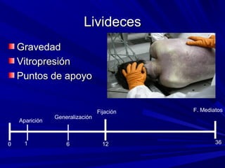 LLiivviiddeecceess 
GGrraavveeddaadd 
VViittrroopprreessiióónn 
PPuunnttooss ddee aappooyyoo 
Aparición Generalización 
Fijación F. Mediatos 
0 1 6 12 36 
 