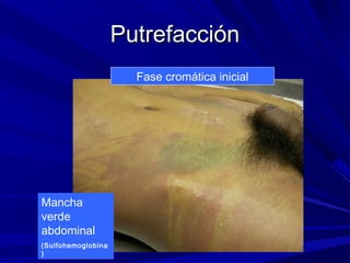 PPuuttrreeffaacccciióónn 
Fase cromática inicial 
Mancha 
verde 
abdominal 
(Sulfohemoglobina 
) 
 