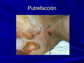 PPuuttrreeffaacccciióónn 
 