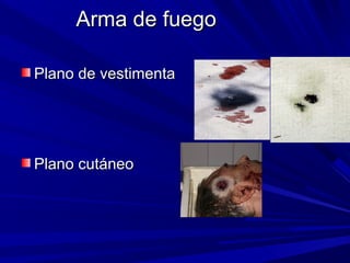 AArrmmaa ddee ffuueeggoo 
PPllaannoo ddee vveessttiimmeennttaa 
PPllaannoo ccuuttáánneeoo 
 