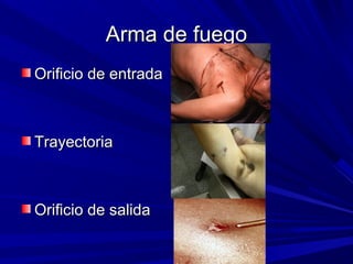 AArrmmaa ddee ffuueeggoo 
OOrriiffiicciioo ddee eennttrraaddaa 
TTrraayyeeccttoorriiaa 
OOrriiffiicciioo ddee ssaalliiddaa 
 