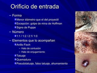 OOrriiffiicciioo ddee eennttrraaddaa 
– FFoorrmmaa 
MMeennoorr ddiiáámmeettrroo qquuee eell ddeell pprrooyyeeccttiill 
EExxcceeppcciióónn:: ggoollppee ddee mmiinnaa ddee HHooffffmmaann 
SSiiggnnoo ddee PPuuppppee 
– NNúúmmeerroo 
11::11 / 11::22 / 22::11/ 11::00 
– EElleemmeennttooss qquuee lloo aaccoommppaaññaann 
AAnniilllloo FFiisscchh 
– HHaalloo ddee ccoonnttuussiióónn 
– HHaalloo ddee eennjjuuggaammiieennttoo 
TTaattuuaajjee 
QQuueemmaadduurraa 
PPsseeuuddoottaattuuaajjee,, ffaallssoo ttaattuuaajjee,, aahhuummaammiieennttoo 
 