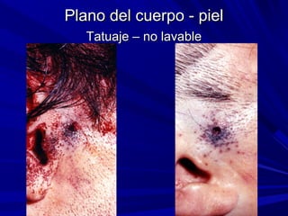 Plano ddeell ccuueerrppoo -- ppiieell 
TTaattuuaajjee –– nnoo llaavvaabbllee 
 