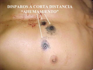 DISPAROS A CORTA DISTANCIA 
“AHUMAMIENTO” 
 