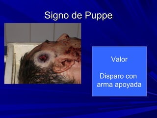 SSiiggnnoo ddee PPuuppppee 
Valor 
Disparo con 
arma apoyada 
 
