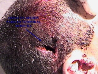 OEPAF EN REGIÓN 
PARIETO TEMPORAL 
DERECHA 
 