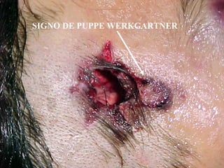 SIGNO DE PUPPE WERKGARTNER 
 