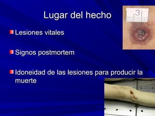 LLuuggaarr ddeell hheecchhoo 
LLeessiioonneess vviittaalleess 
SSiiggnnooss ppoossttmmoorrtteemm 
IIddoonneeiiddaadd ddee llaass lleessiioonneess ppaarraa pprroodduucciirr llaa 
mmuueerrttee 
 